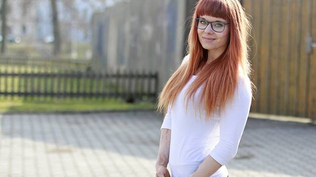 Marie Žampachová z Litvínova trpí ichtyózou, vzácným a závažným kožním onemocněním 