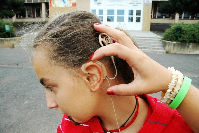 Za uchem má Adélka mikrofon, je propojen s procesorem. Kochleární implantát má pod kůží, kde je natrvalo. 