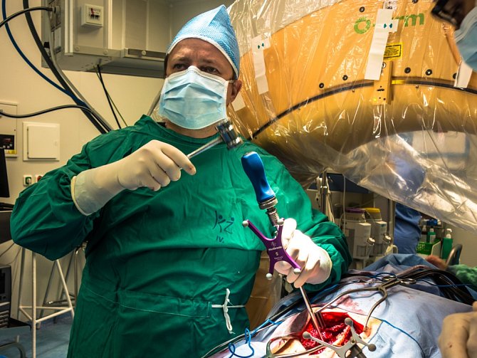 OPERACE PÁTEŘE. Neurochirurg Petr Vachata provádí unikátní operaci na klinice v Ústí.
