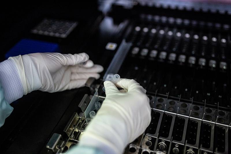 Laborantky v mikrobiologické laboratoři trutnovské nemocnice zkoumají přítomnost koronaviru v donesených vzorcích.
