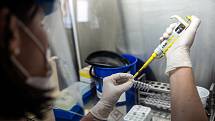 Laborantky v mikrobiologické laboratoři trutnovské nemocnice zkoumají přítomnost koronaviru v donesených vzorcích.
