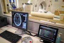 Opotřebený desetiletý počítačový tomograf tak nahradil nový, stejně tak, jak tomu bylo v Nemocnici Karlovy Vary, kde nové CT slouží už od června 2022.
