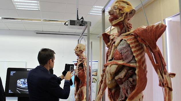 Studenti kladenské biomedicíny získali k výuce plastinovaná lidská těla -  Kladenský deník