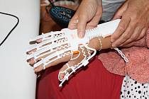 Robotická rukavice pomáhá při rehabilitaci v Domově sv. Josefa v Žirči.
