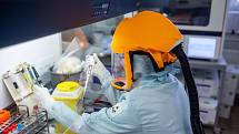 Laborantky v mikrobiologické laboratoři trutnovské nemocnice zkoumají přítomnost koronaviru v donesených vzorcích, vyšetřily jich už 3174.