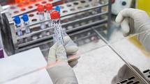 Laboratorní vyšetření na Covid-19 metodou PCR v trutnovské nemocnici.