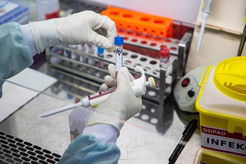 Laboratorní vyšetření na Covid-19 metodou PCR v trutnovské nemocnici.