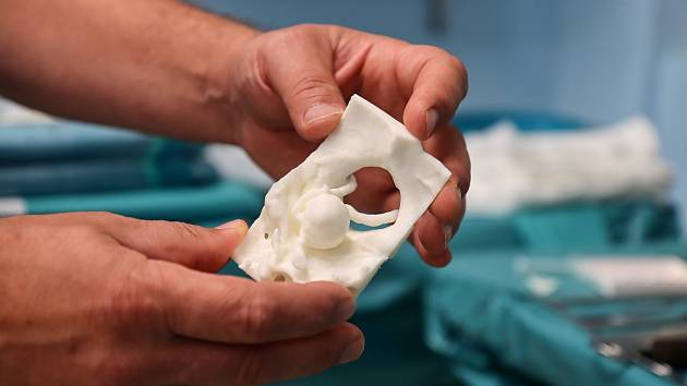 Krajská nemocnice v Liberci používá 3D tisk například při plánování náročných operačních zákroků.
