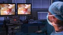NEJPRVE SE MUSÍ v příslušných místech propíchnout břicho pacienta. Dvěma otvory se vsune do břicha laparoskopický nástroj, jedním kamera, kterou lékařka Romana Gaalová zobrazuje místo operace.