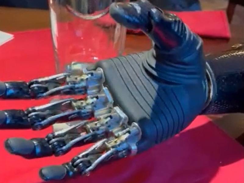 Jonáš Kešnar a jeho "robotická" ruka.