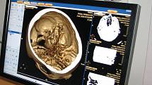 Pohled, který se hned tak někomu nenaskytne, byl ve čtvrtek v jindřichohradecké nemocnici na nové CT, bylo totiž otevřené. 