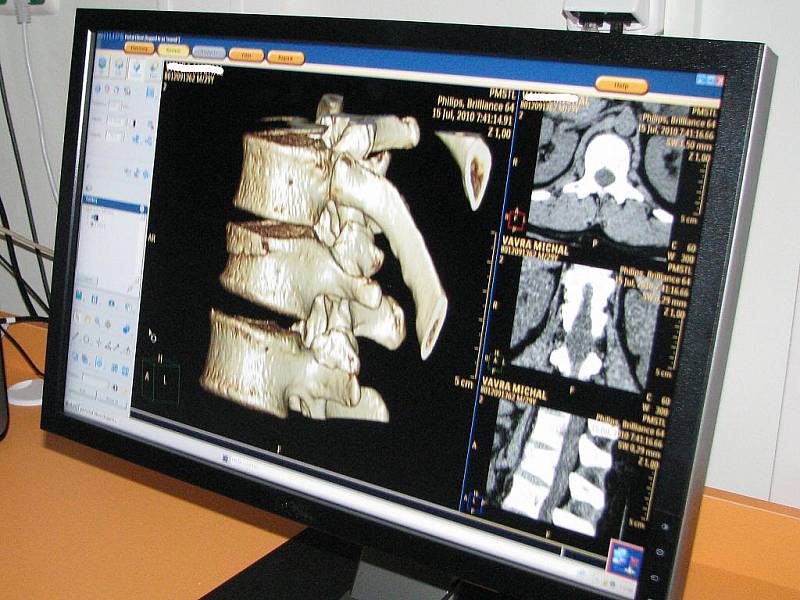 Pohled, který se hned tak někomu nenaskytne, byl ve čtvrtek v jindřichohradecké nemocnici na nové CT, bylo totiž otevřené. 