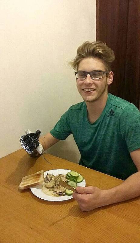 Jonáš Kešnar se s novou elektronickou protézou učí například jíst vidličkou a nožem.