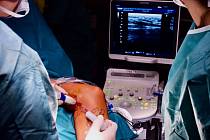 Na operace křečových žil používají lékaři písecké nemocnice nový laser. Dokáže pracovat daleko přesněji než starší technika.