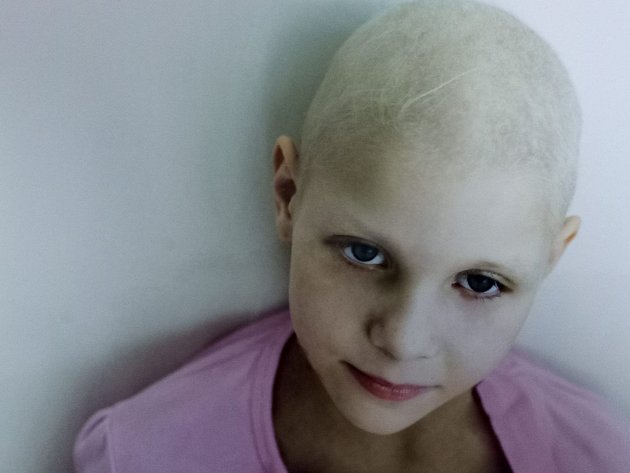 Už jako malá holčička musela podstoupit chemoterapii.