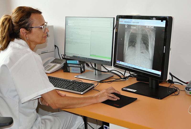 Vsetínská nemocnice pořídila díky evropské dotaci diagnostické monitory za více než dva a půl milionu korun.