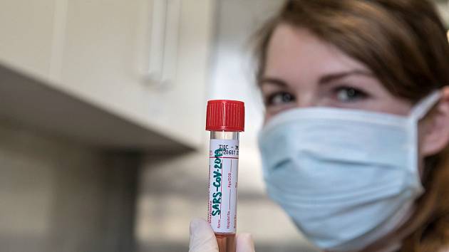 Laboratorní vyšetřování koronaviru - ilustrační foto.