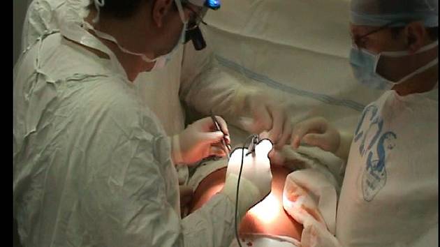 Stále více operačních zákroků se v brodské nemocnici provádí laparoskopicky.