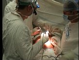 Stále více operačních zákroků se v brodské nemocnici provádí laparoskopicky.