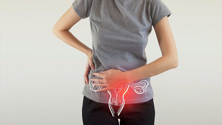 Pokles dělohy je pro ženy problém často spojený s velkou bolestí. Ilustrační foto: Se souhlasem Stránky medicíny