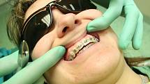 Podle aktuálních výsledků průzkumu skupiny Labs1503 je s vyrovnaností a pravidelností svých zubů spokojeno pouhých osmatřicet procent Čechů. 
