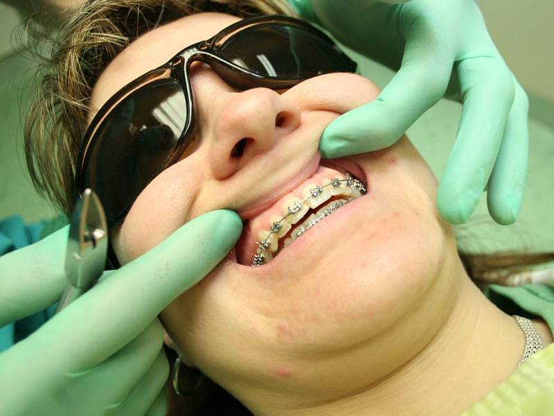 Podle aktuálních výsledků průzkumu skupiny Labs1503 je s vyrovnaností a pravidelností svých zubů spokojeno pouhých osmatřicet procent Čechů. 