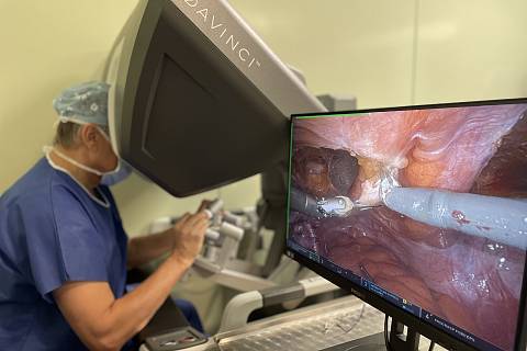 Robotická operativa slaví v jihlavské nemocnici první narozeniny. Lékaři díky nejmodernějšímu přístroji na trhu pomohli téměř dvěma stovkám pacientů napříč chirurgickým, gynekologickým a urologickým odvětvím.