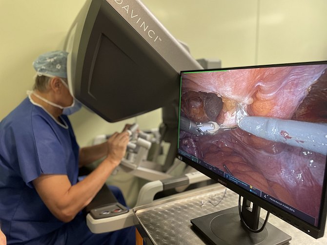 Robotická operativa slaví v jihlavské nemocnici první narozeniny. Lékaři díky nejmodernějšímu přístroji na trhu pomohli téměř dvěma stovkám pacientů napříč chirurgickým, gynekologickým a urologickým odvětvím.