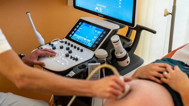 Ultrazvukové přístroje pro nemocnici Náchod
