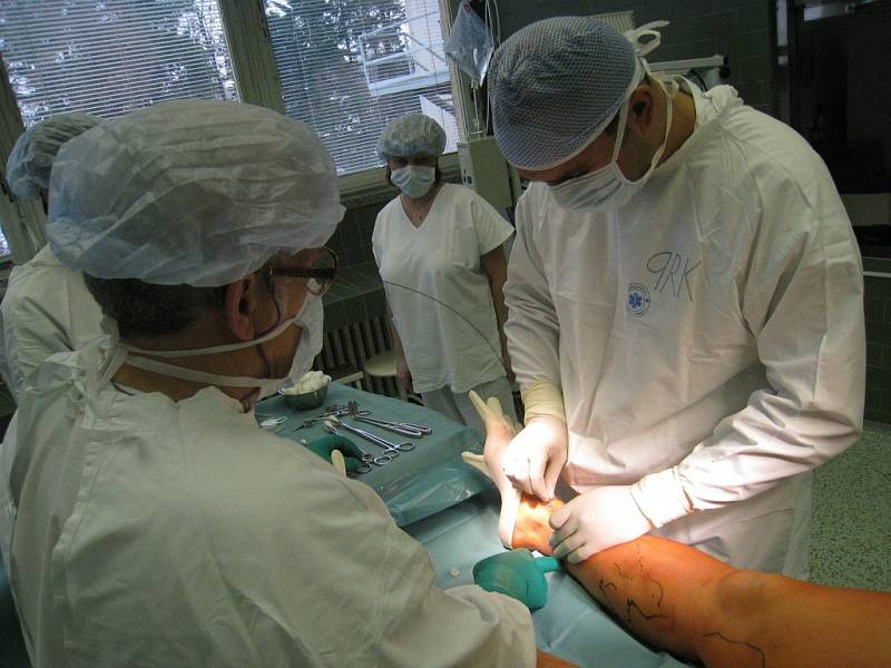 Dvě jizvičky zůstanou po operaci křečových žil „mikrovlnkou“.