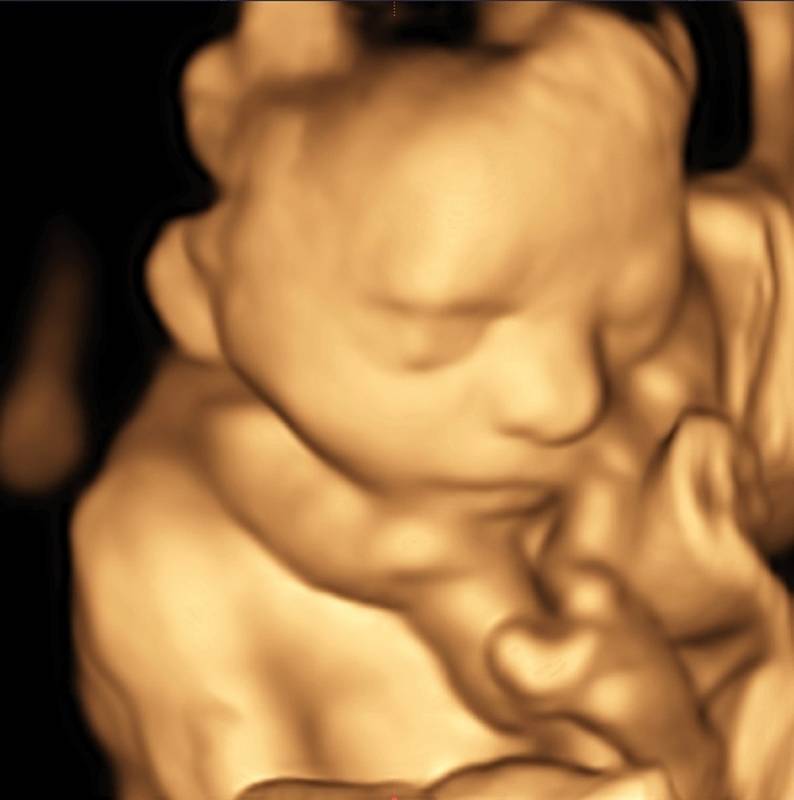 VÝSLEDKEM 4D ultrazvuku jsou statické i  dynamické obrázky z nitroděložního života. Blíží se vánoční svátky a 4D ultrazvuk je vhodný  jako dárek, potěší rodiče i prarodiče.  Více informací a fotek na webech   arleta.cz    a      rychnovsky.deník.cz/arleta