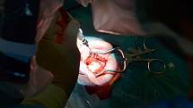 Operaci středního ucha v přímém přenosu sledují lékaři z celé republiky ve svitavské nemocnici.