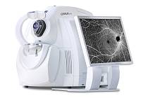 Optická koherentní tomografie je velká asi jako stolní počítač. Vyjde na tři miliony korun.
