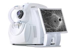 Optická koherentní tomografie je velká asi jako stolní počítač. Vyjde na tři miliony korun.