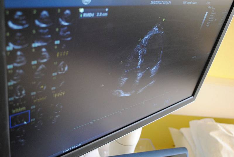 Nové ultrazvukové diagnostické přístroje v třebíčské nemocnici.