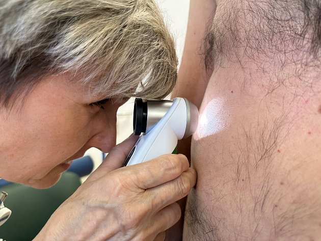 Den melanomu v Třebíči: lékařky odhalily deset zhoubných nádorů