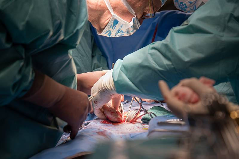 Specialisté z Urologické kliniky Fakultní nemocnice Olomouc využili k vyjmutí ledviny z těla žijícího dárce při příbuzenské transplantaci orgánu robotický systém da Vinci. Jednalo o vůbec první operaci tohoto druhu v České republice.
