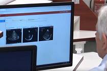 Softwarová aplikace Cereb B-Mode Assist, která pomáhá diagnostikovat Parkinsonovu chorobu.