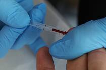 Bezplatné anonymní testování na HIV. Ilustrační foto