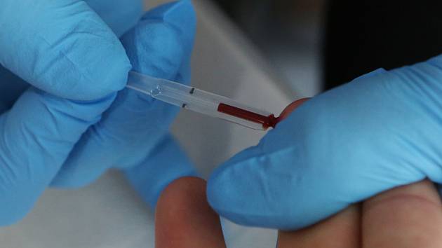 V Třebíči začne týden testování na HIV a žloutenky