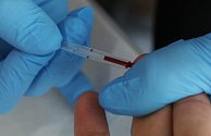 Bezplatné anonymní testování na HIV. Ilustrační foto