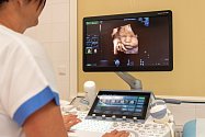 Porodnicko-gynekologická klinika FN Olomouc pořídila nejnovější ultrazvuky, nahrazují záznam srdečních ozev plodu. Díky moderním technologiím, které má klinika k dispozici, mohou budoucí maminky získat 3D zobrazení plodu nebo 4D video. Ilustrační snímek.