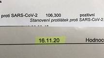 Vyšetření protilátek proti onemocnění Covid-19 na olomoucké poliklinice, 8. prosince 2020