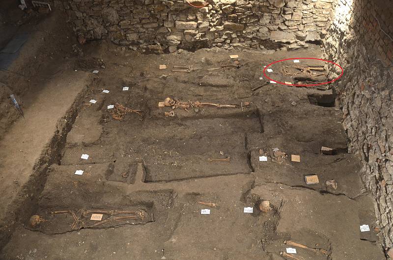 Při záchranném archeologickém průzkumu v Olomouci byl zjištěn syfilis šířící se Evropou od konce 15. století. Při výzkumu byly odkryty stovky hrobů.
