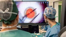 Specialisté z Oční kliniky Fakultní nemocnice Olomouc mohou nově využívat nejmodernější verzi operačního systému od společnosti Alcon.