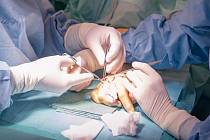 Olomoučtí plastičtí chirurgové operují ženu, které část prostředníčku ukousl bojový pes. Ruku jí zachránili akutním přenosem prstu z nohy na postižené místo.