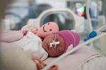Lékaři už dokáží zachránit i děti, narozené ve 24. týdnu těhotenství. Na snímku je novorozenec, který přišel na svět v necelém 27. týdnu. Výzkumníci tvrdí, že takovým dětem zvýší šance na přežití přestřižení pupečníku alespoň minutu po porodu.