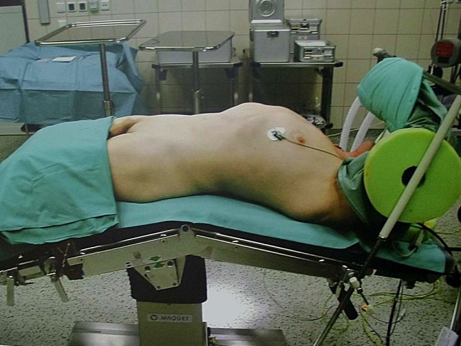 Příprava na operaci prostaty. Ze série Tichá nemoc fotografa Jindřicha Štreita