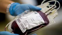 Aktuálně Nemocnice Pardubického kraje přijme všechny zájemce o darování krve.