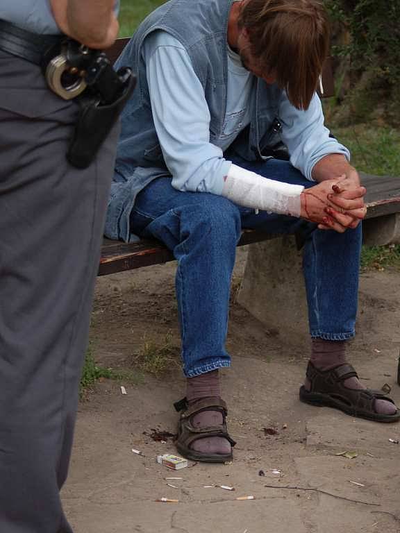 Léto 2008 - sebevrah v Tyršových sadech. I zde asistovali lékařům policisté.
